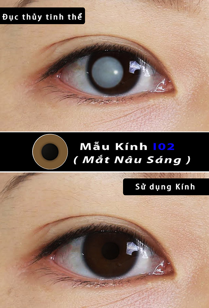 LENS THẨM MỸ- MÀU NÂU SÁNG (I02)