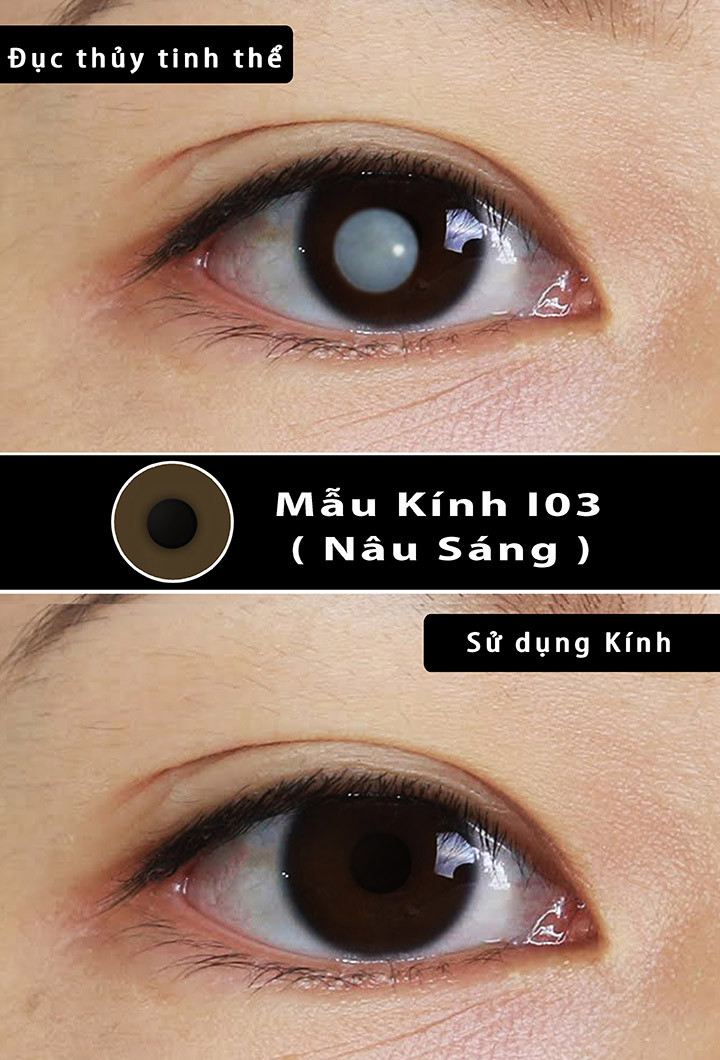 LENS CHE KHUYẾT ĐIỂM MÀU NÂU (I03)