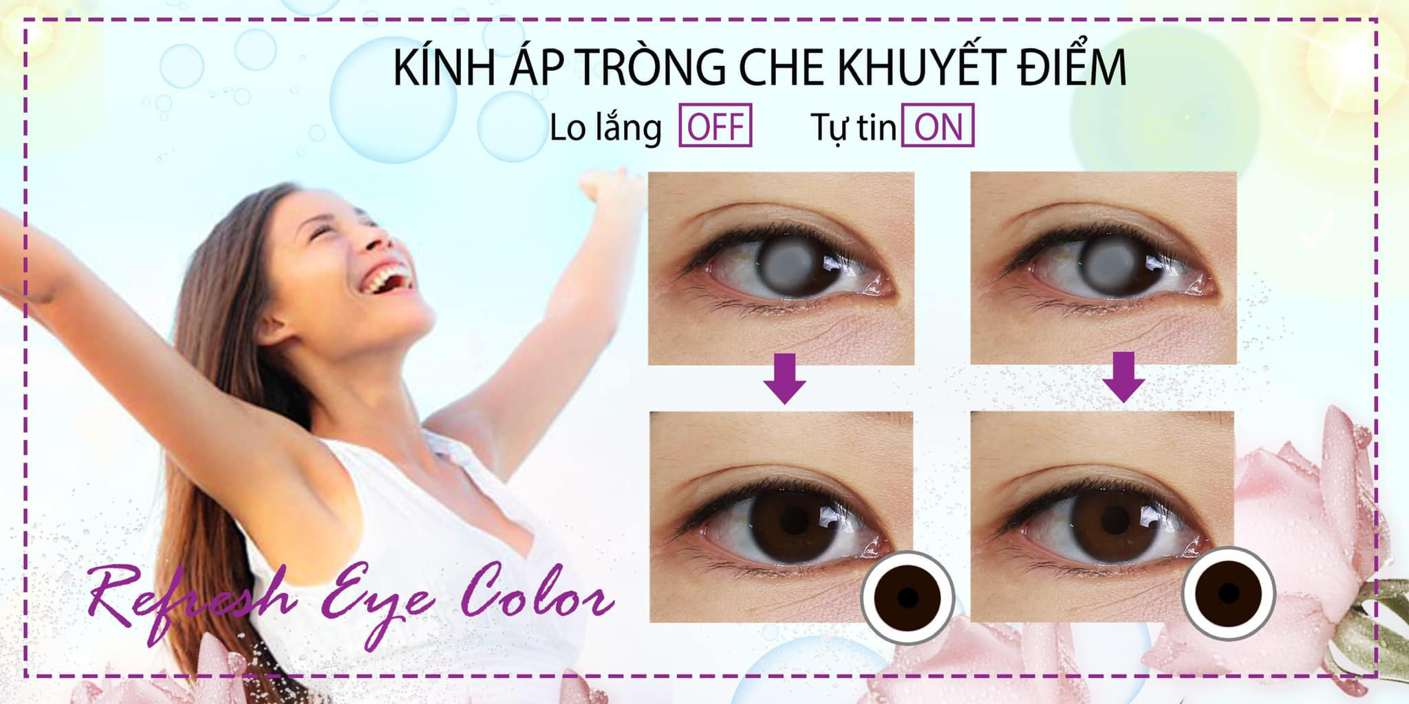 KÍNH ÁP TRÒNG THẨM MỸ- CHE KHUYẾT ĐIỂM